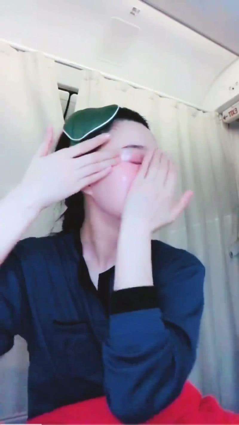 痘印日常_痘印心得经验_痘印的烦恼