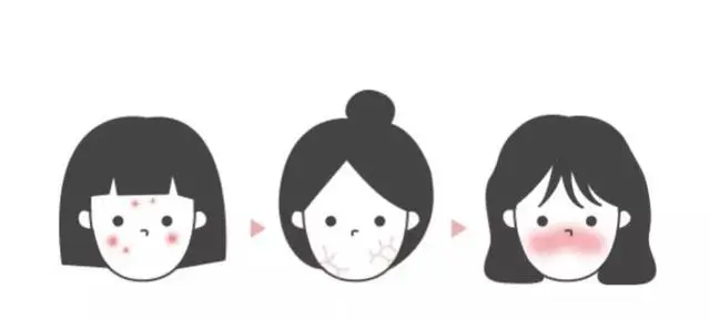 痘印的烦恼_痘印日常_痘印心得经验