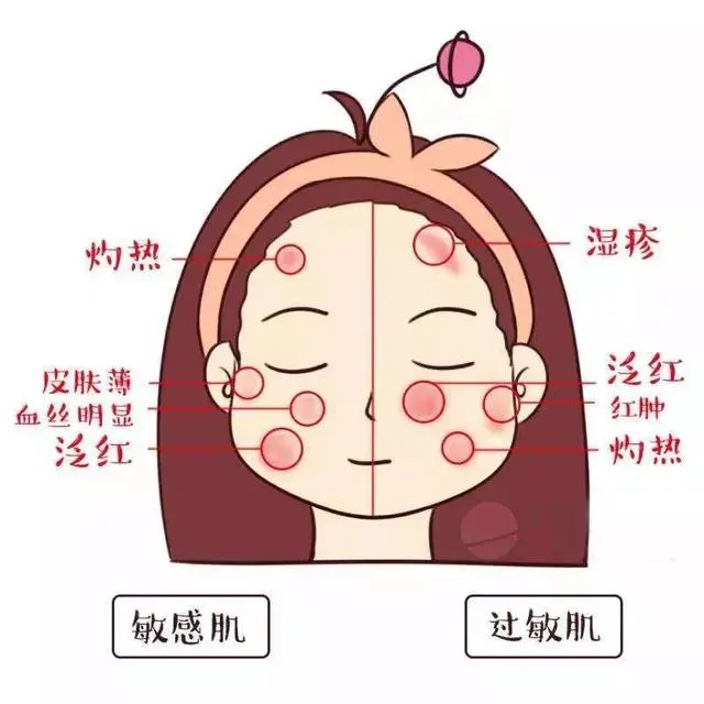 痘印日常_痘印心得经验_痘印的烦恼