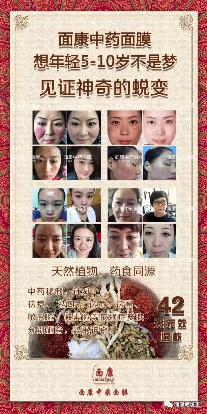 痘印心得经验_痘印的解决方法_痘印日常