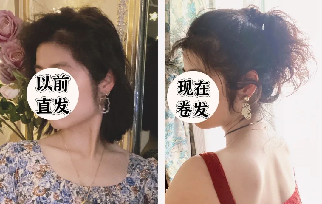 痘印过程_痘印心得经验_痘印如何处理