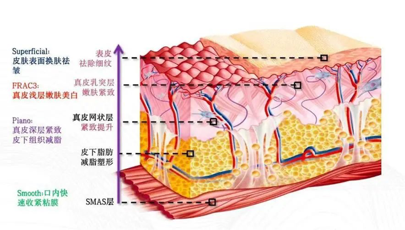 痘印心得经验_痘印过程_痘印如何处理