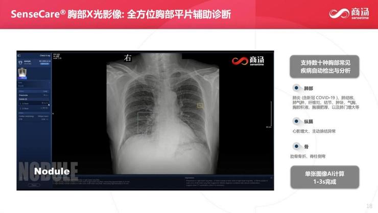 一个医疗器械销售心得_医疗设备销售经验心得_销售医疗设备的工作总结
