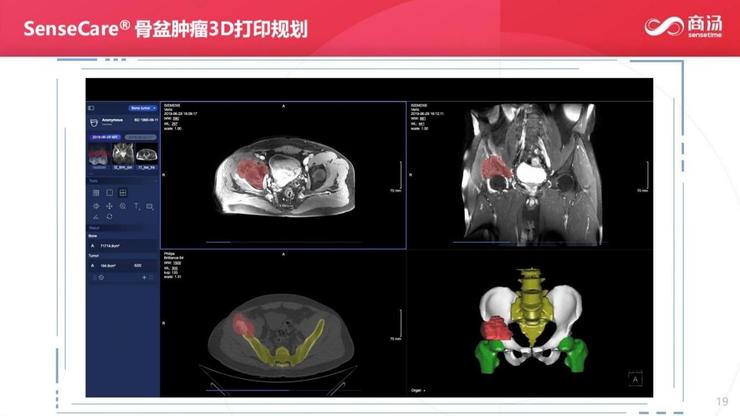 销售医疗设备的工作总结_一个医疗器械销售心得_医疗设备销售经验心得