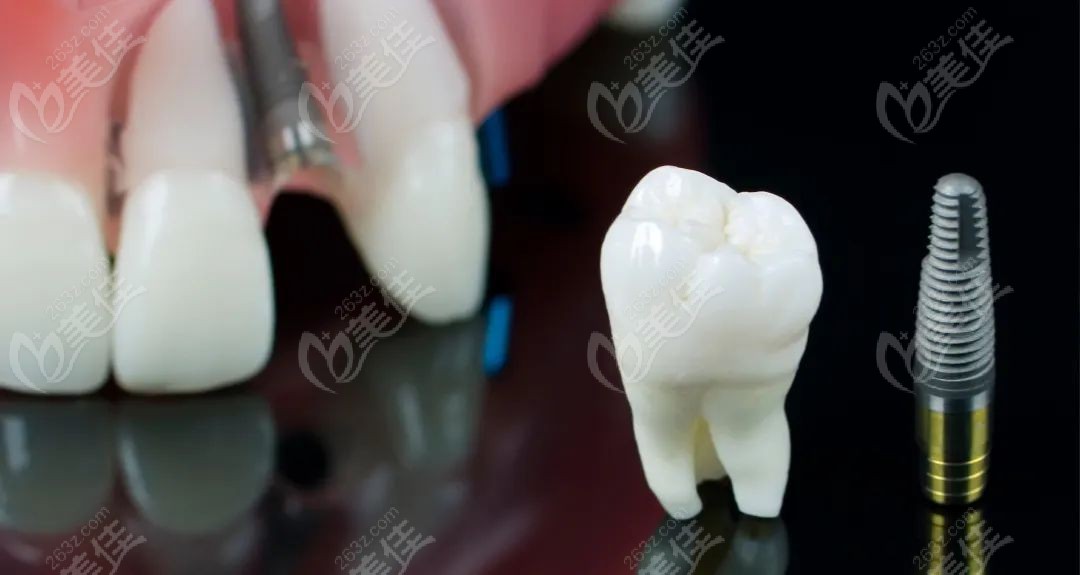 玉环市牙科推荐236z.com