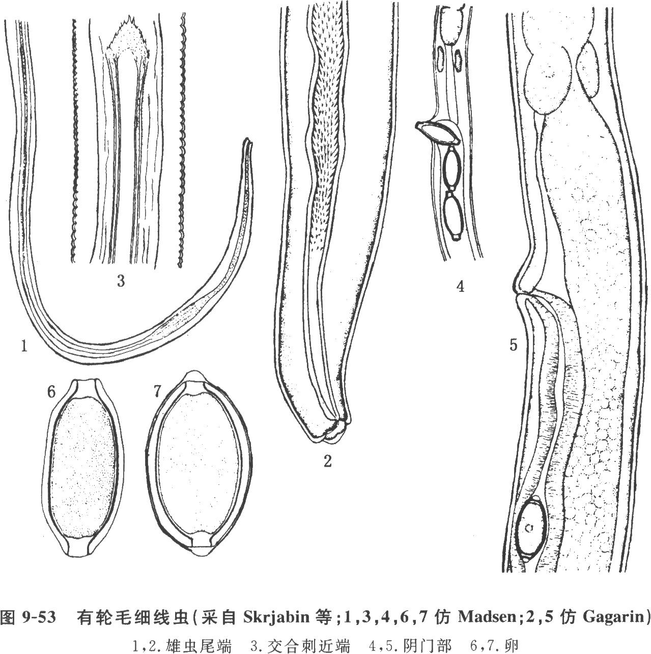 禽毛细线虫病的症状、诊断和防冶方法