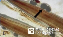珍珠养殖龙胆池塘技术要求_珍珠养殖龙胆池塘技术与管理_珍珠龙胆池塘养殖技术