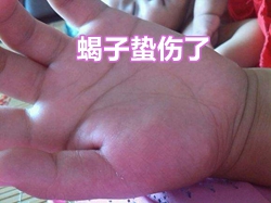 野生蝎子冬天怎么养殖技术_野生蝎子家养_养野生蝎子怎样过冬