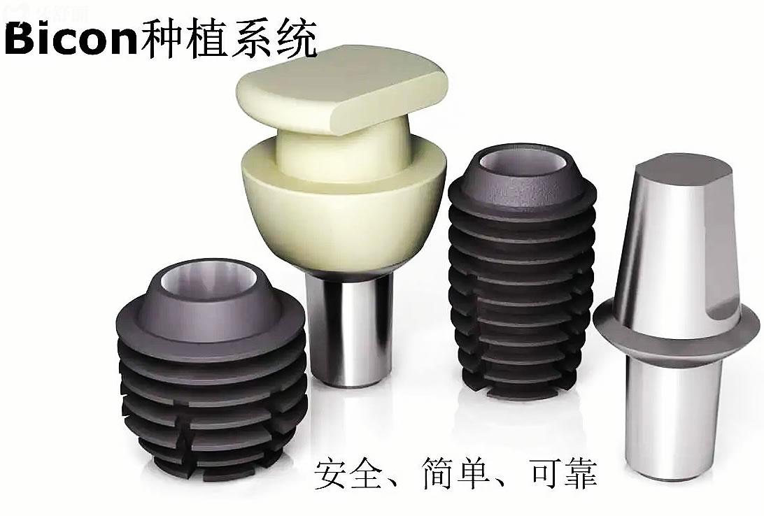 种植牙品牌排行榜中有哪些，十大种植牙系统品牌哪个好