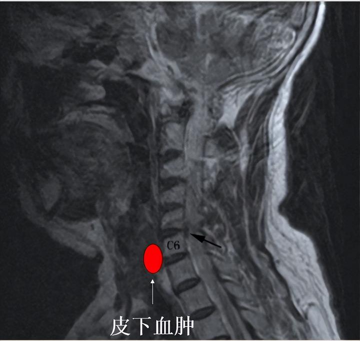 优质护理服务经验交流_的优质护理服务经验_优质护理服务经验报告