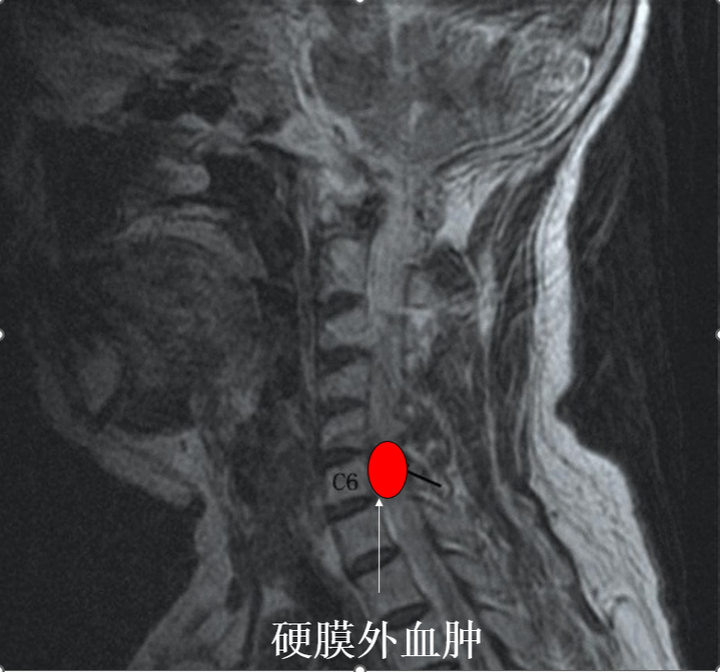 优质护理服务经验报告_的优质护理服务经验_优质护理服务经验交流