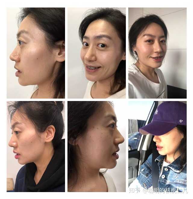 优秀回答_优质回答问题经验分享_经验分享提问