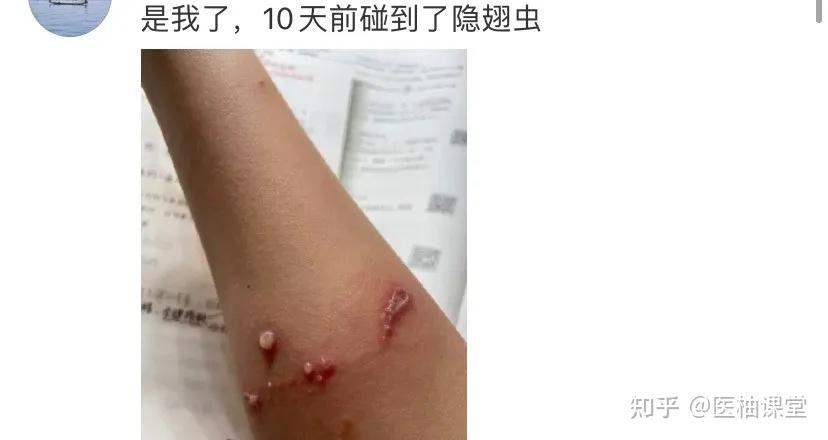 致富经虫子_养虫致富_致富经昆虫养殖