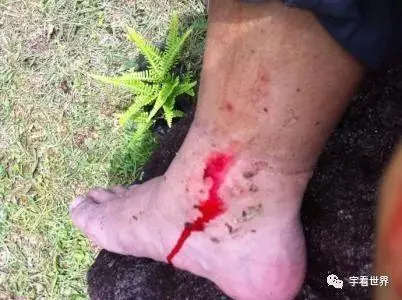 海南养殖蚂蝗技术有前途吗_海南有养水蛭的吗_海南哪里有蚂蝗养殖技术