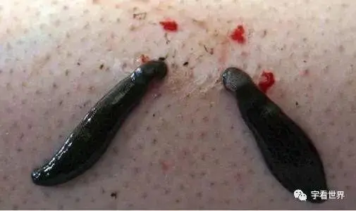 海南有养水蛭的吗_海南哪里有蚂蝗养殖技术_海南养殖蚂蝗技术有前途吗