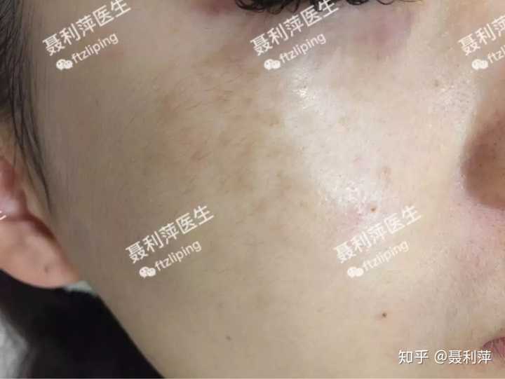 青斑鱼养殖技术_养殖青斑鱼多少钱一斤_青斑养殖技术