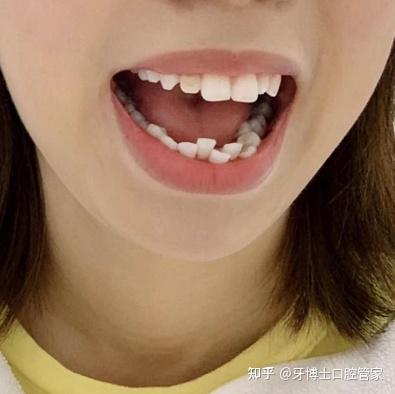 优质回答的标准是什么_提交优质回答_优质回答的经验和感受