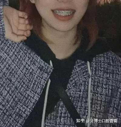 提交优质回答_优质回答的经验和感受_优质回答的标准是什么