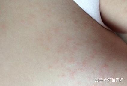 优质护理经验交流_护理优质经验交流发言_护理优质经验交流ppt