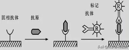 内分泌优质护理经验_优质护理经验交流_护理经验丰富