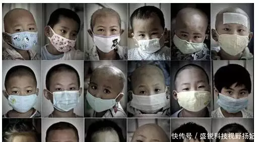白血病治好后能活多少年有经验的网友热心回答播报文章