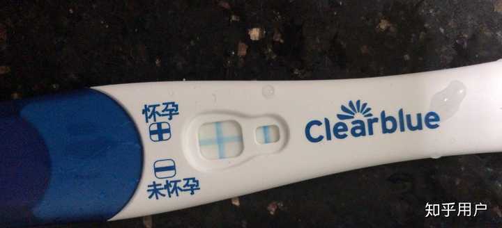 男性结扎是种什么样的体验？