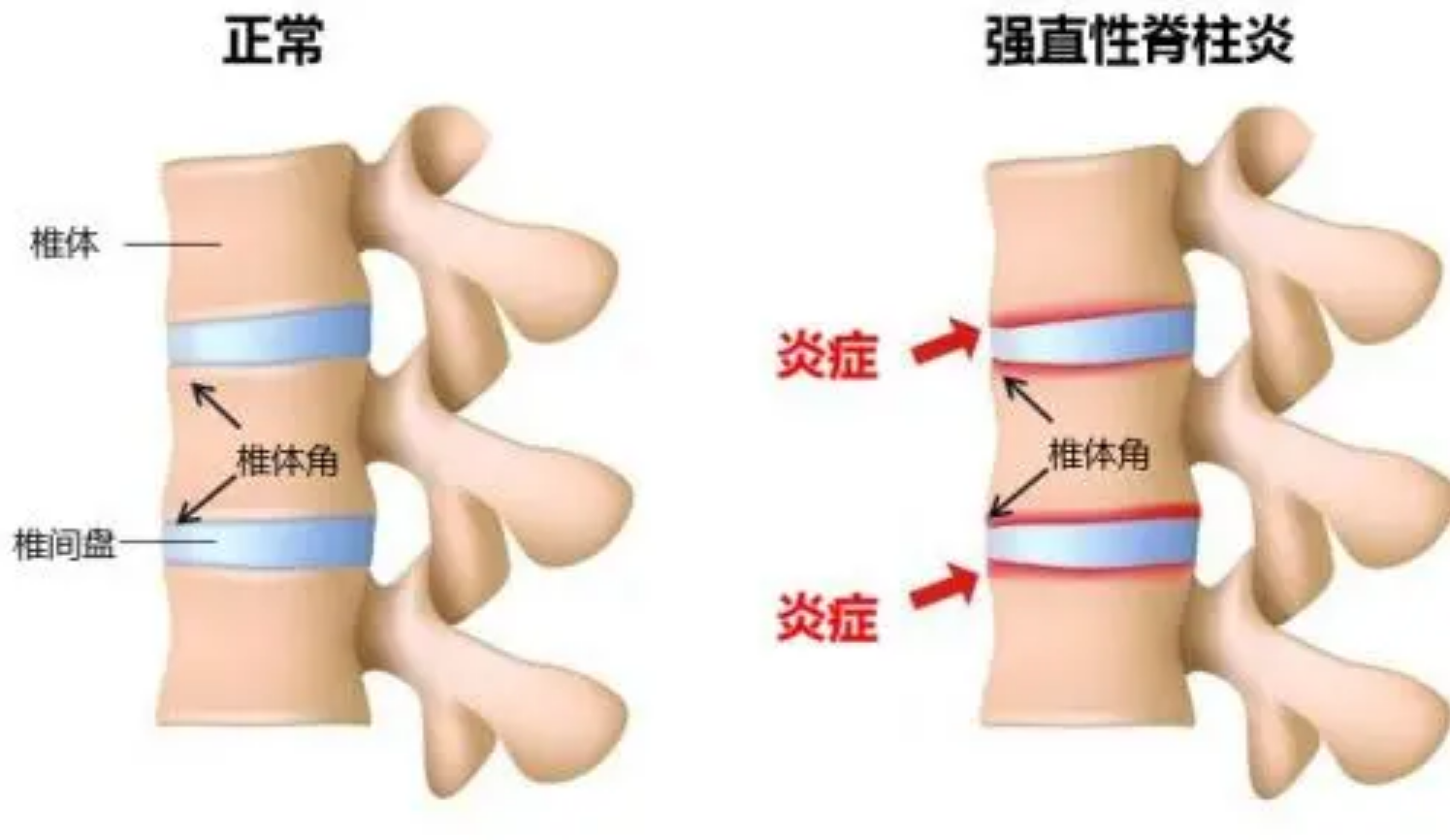 致富经蛇王姐姐险中求富_致富经蛇_致富经大王蛇